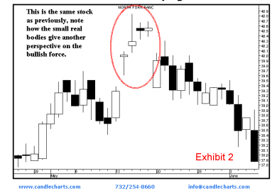 candlestick chart